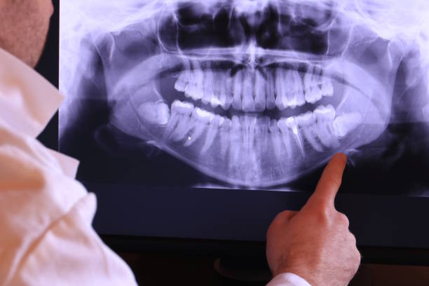Best Emergency Treatment for Dental Infections or Abscesses in Cedar Mill, OR
